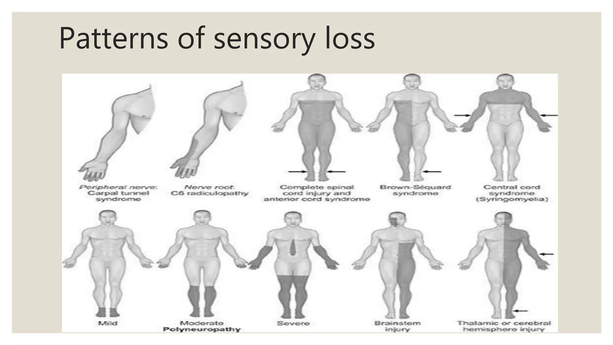 Patterns of sensory loss
 