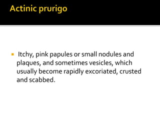  Itchy, pink papules or small nodules and
plaques, and sometimes vesicles, which
usually become rapidly excoriated, crusted
and scabbed.
 