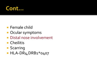  Female child
 Ocular symptoms
 Distal nose involvement
 Cheilitis
 Scarring
 HLA-DR4,DRB1*0407
 