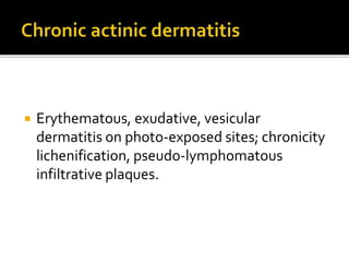  Erythematous, exudative, vesicular
dermatitis on photo‐exposed sites; chronicity
lichenification, pseudo‐lymphomatous
infiltrative plaques.
 