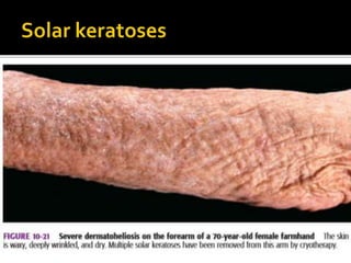 Approach to photodermatoses