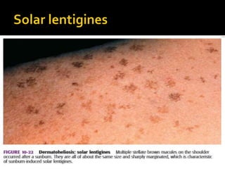 Approach to photodermatoses