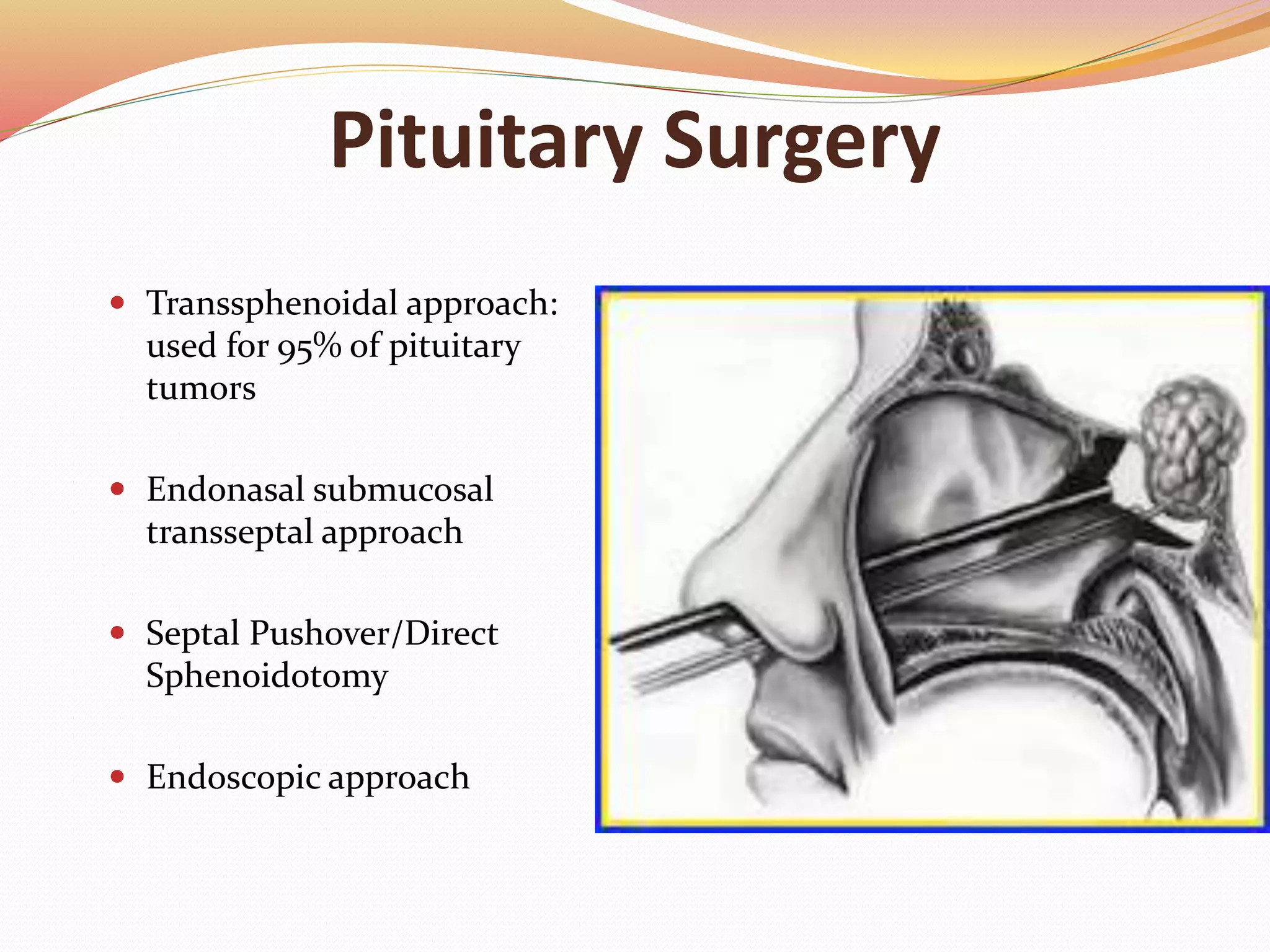Pituitary Surgery
 Transsphenoidal approach:
used for 95% of pituitary
tumors
 Endonasal submucosal
transseptal approach
 Septal Pushover/Direct
Sphenoidotomy
 Endoscopic approach
 