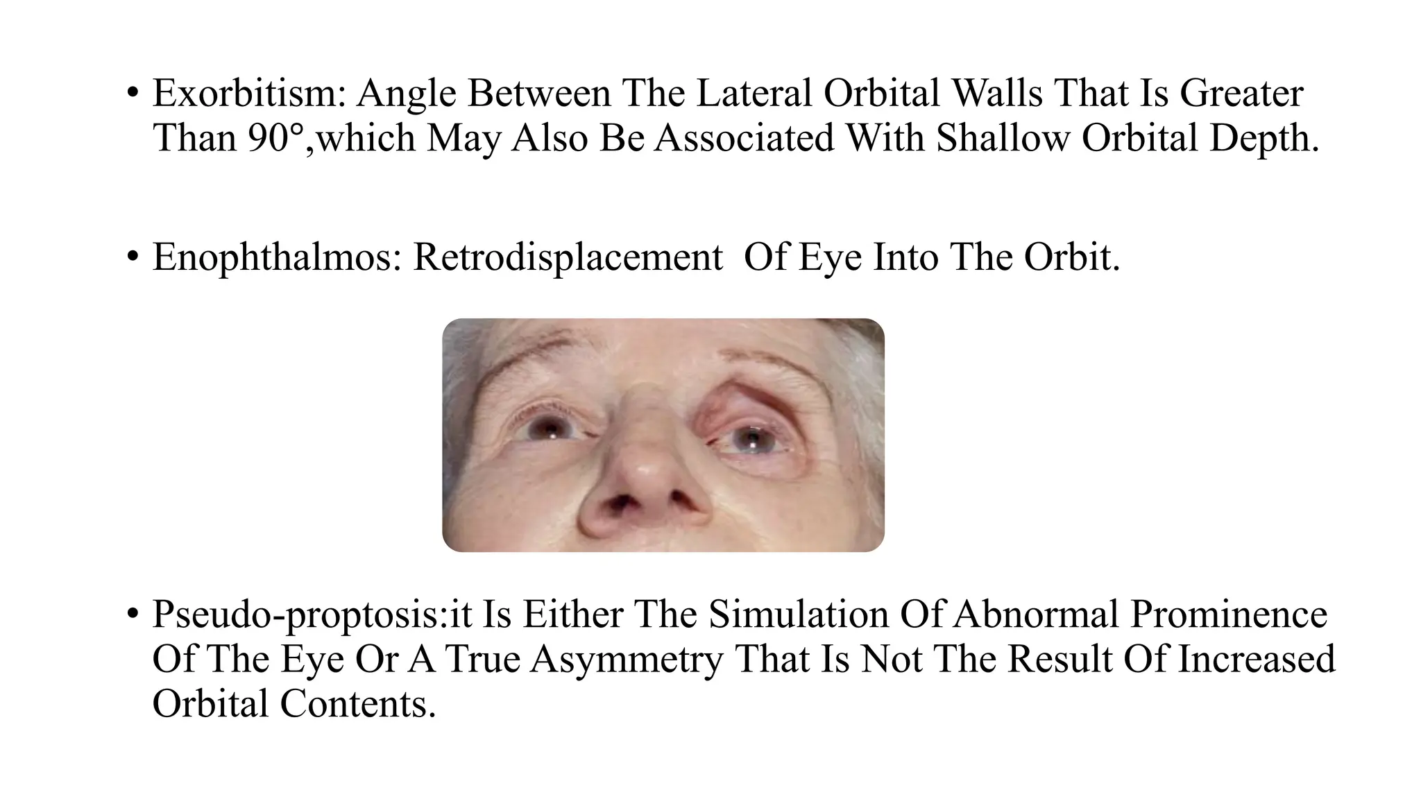 APPROACH TO PROPTOSIS.pptx..................... | PPTX