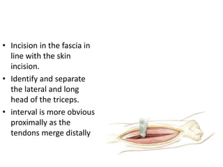 Approach to proximal arm | PPTX