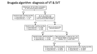 Approach to qrs wide complex tachycardias copy | PPTX