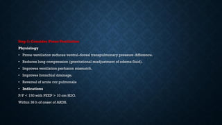 Step 5: Consider ProneVentilation
Physiology
• Prone ventilation reduces ventral-dorsal transpulmonary pressure difference.
• Reduces lung compression (gravitational readjustment of edema fluid).
• Improves ventilation perfusion mismatch.
• Improves bronchial drainage.
• Reversal of acute cor pulmonale
• Indications
P/F < 150 with PEEP > 10 cm H2O.
Within 36 h of onset of ARDS.
 