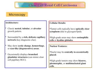Alveolar Pattern Rcc Approach to Renal cell carcinoma(RCC).pptx