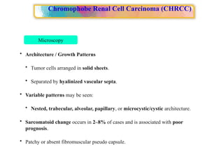 Alveolar Pattern Rcc Approach to Renal cell carcinoma(RCC).pptx