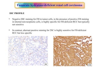 Approach to Renal cell carcinoma(RCC).pptx