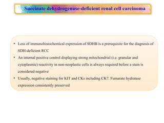 Approach to Renal cell carcinoma(RCC).pptx