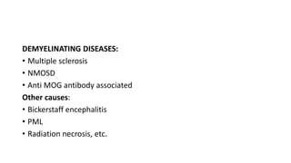 DEMYELINATING DISEASES:
• Multiple sclerosis
• NMOSD
• Anti MOG antibody associated
Other causes:
• Bickerstaff encephalitis
• PML
• Radiation necrosis, etc.
 