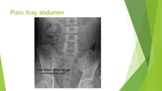 Approach to right iliac fossa(RIF) pain | PPTX