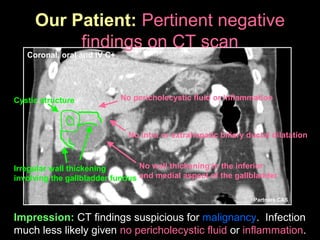 Partners CAS
Impression: CT findings suspicious for malignancy. Infection
much less likely given no pericholecystic fluid or inflammation.
Our Patient: Pertinent negative
findings on CT scan
Coronal, oral and IV C+
No wall thickening in the inferior
and medial aspect of the gallbladder
No pericholecystic fluid or inflammation
No intra or extrahepatic biliary ductal dilatation
Cystic structure
Irregular wall thickening
involving the gallbladder fundus
 