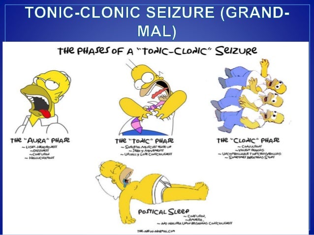 seizures symptoms approach to seizure cme seizures symptoms approach to seizure cme