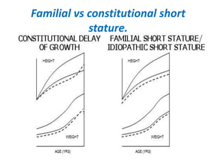 approach-to-short-stature-pptx