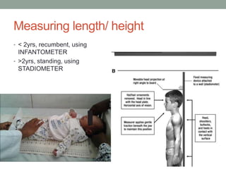 Recumbent Length Approach to short stature-the latest one.pptx