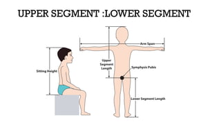 Segment Inferior APPROACH TO SHORT STATURE in pediatrics age group | PPTX
