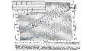APPROACH TO SHORT STATURE. Managementpptx | PPTX