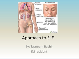 Approach to SLE
By: Tasneem Bashir
IM resident
 