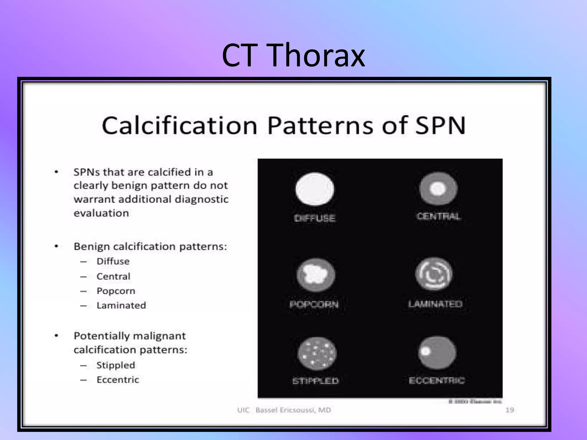 Approach to solitary pulmonary nodule | PPTX