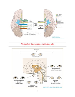 13
Những bất thường đồng tử thường gặp
 
