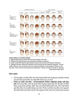 19
Định nghĩa
• Cả hai phản xạ đều kiểm tra một mạch thần kinh tương tự (similar neural
circuit) liên quan đến các dây thần kinh sọ 3, 6 và 8.
• Phản xạ nhãn cầu-đầu - Oculocephalic Reflex (Nghiệm pháp mắt búp
bê): Khi xoay đầu, mắt sẽ quay theo hướng ngược lại (do đó giữ cố định
theo cùng một hướng). Điều này có thể dễ dàng kiểm tra, như một đánh
giá đầu tiên về chuyển động của mắt. Phản xạ nhãn cầu-đầu còn nguyên
vẹn phản đối một cách mạnh mẽ nguyên nhân cấu trúc (structural cause)
 