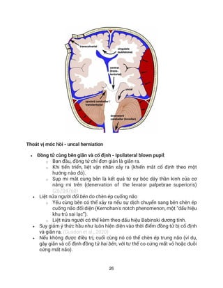 26
Thoát vị móc hồi - uncal herniation
• Đồng tử cùng bên giãn và cố định - Ipsilateral blown pupil:
o Ban đầu, đồng tử chỉ đơn giản là giãn ra.
o Khi tiến triển, liệt vận nhãn xảy ra (khiến mắt cố định theo một
hướng nào đó).
o Sụp mi mắt cùng bên là kết quả từ sự bóc dây thần kinh của cơ
nâng mi trên (denervation of the levator palpebrae superioris)
(26704760)
• Liệt nửa người đối bên do chèn ép cuống não
o Yếu cùng bên có thể xảy ra nếu sự dịch chuyển sang bên chèn ép
cuống não đối diện (Kernohan's notch phenomenon, một “dấu hiệu
khu trú sai lạc”).
o Liệt nửa người có thể kèm theo dấu hiệu Babinski dương tính.
• Suy giảm ý thức hầu như luôn hiện diện vào thời điểm đồng tử bị cố định
và giãn ra. (Gusdon et al., 2020)
• Nếu không được điều trị, cuối cùng nó có thể chèn ép trung não (ví dụ,
gây giãn và cố định đồng tử hai bên, với tư thế co cứng mất vỏ hoặc duỗi
cứng mất não).
 