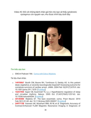 35
Video #2: Đối với những bệnh nhân giả hôn mê, bạn sẽ thấy optokinetic
nystagmus còn nguyên vẹn, như được trình bày dưới đây:
Tìm hiểu sâu hơn:
• EMCrit Podcast 186: Coma with Eelco Wijdicks
Tài liệu tham khảo
• 14970067 Booth CM, Boone RH, Tomlinson G, Detsky AS. Is this patient
dead, vegetative, or severely neurologically impaired? Assessing outcome for
comatose survivors of cardiac arrest. JAMA. 2004 Feb 18;291(7):870-9. doi:
10.1001/jama.291.7.870 [PubMed]
• 16251950 Saper CB, Scammell TE, Lu J. Hypothalamic regulation of sleep
and circadian rhythms. Nature. 2005 Oct 27;437(7063):1257-63. doi:
10.1038/nature04284 [PubMed]
• 20130300 Wijdicks EF. The bare essentials: coma. Pract Neurol. 2010
Feb;10(1):51-60. doi: 10.1136/jnnp.2009.200097 [PubMed]
• 24977138 Vaswani AK, Nizamani WM, Ali M, et al. Diagnostic Accuracy of
Contrast-Enhanced FLAIR Magnetic Resonance Imaging in Diagnosis of
 