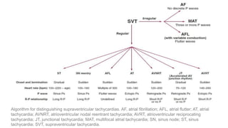 approach to Supraventricular tachycardia | PDF