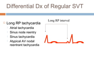 Svt Algorithm Rp Interval Approach to svt | PPT