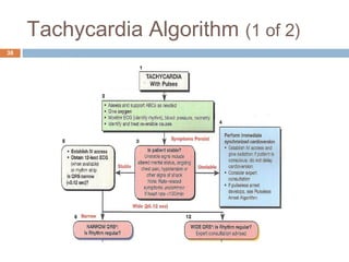 Approach to svt | PPT