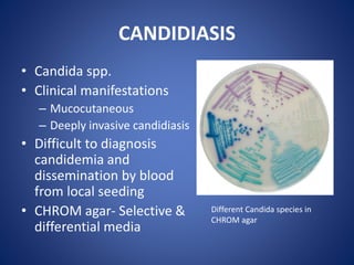 CANDIDIASIS
• Candida spp.
• Clinical manifestations
– Mucocutaneous
– Deeply invasive candidiasis
• Difficult to diagnosis
candidemia and
dissemination by blood
from local seeding
• CHROM agar- Selective &
differential media
Different Candida species in
CHROM agar
 