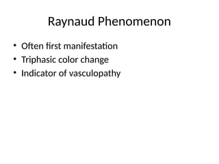 Raynaud Phenomenon
• Often first manifestation
• Triphasic color change
• Indicator of vasculopathy
 