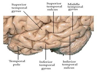 Lower Temporal Approach to temporal lobe | PPTX