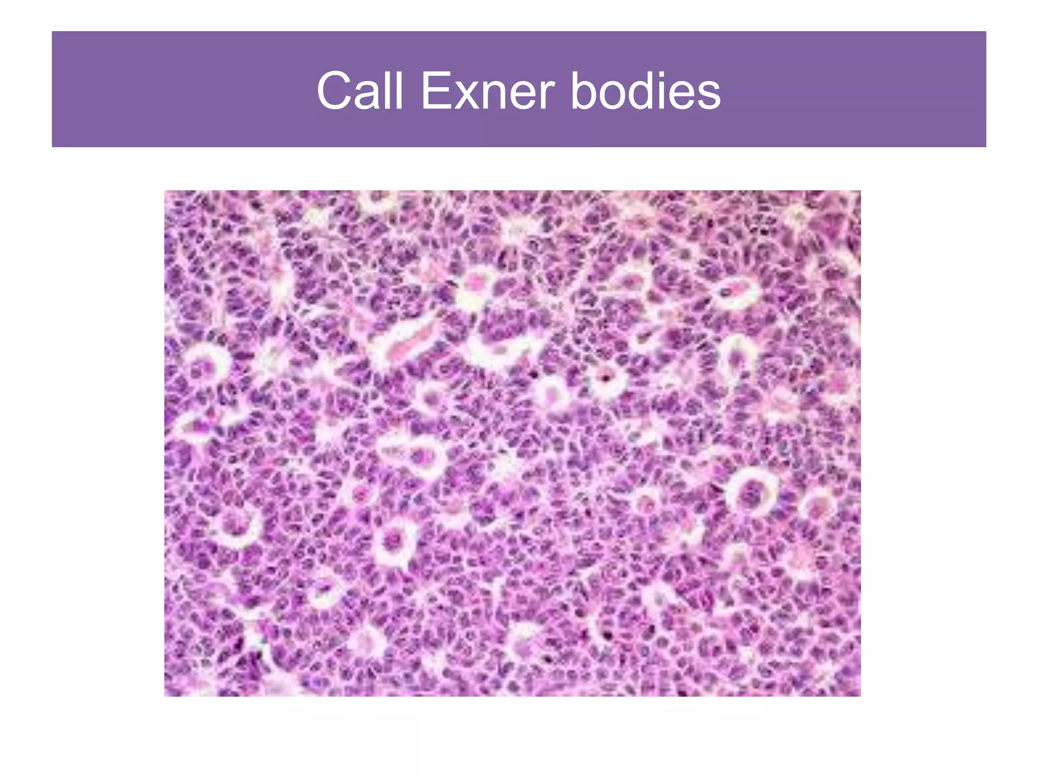 Call Exner bodies
 
