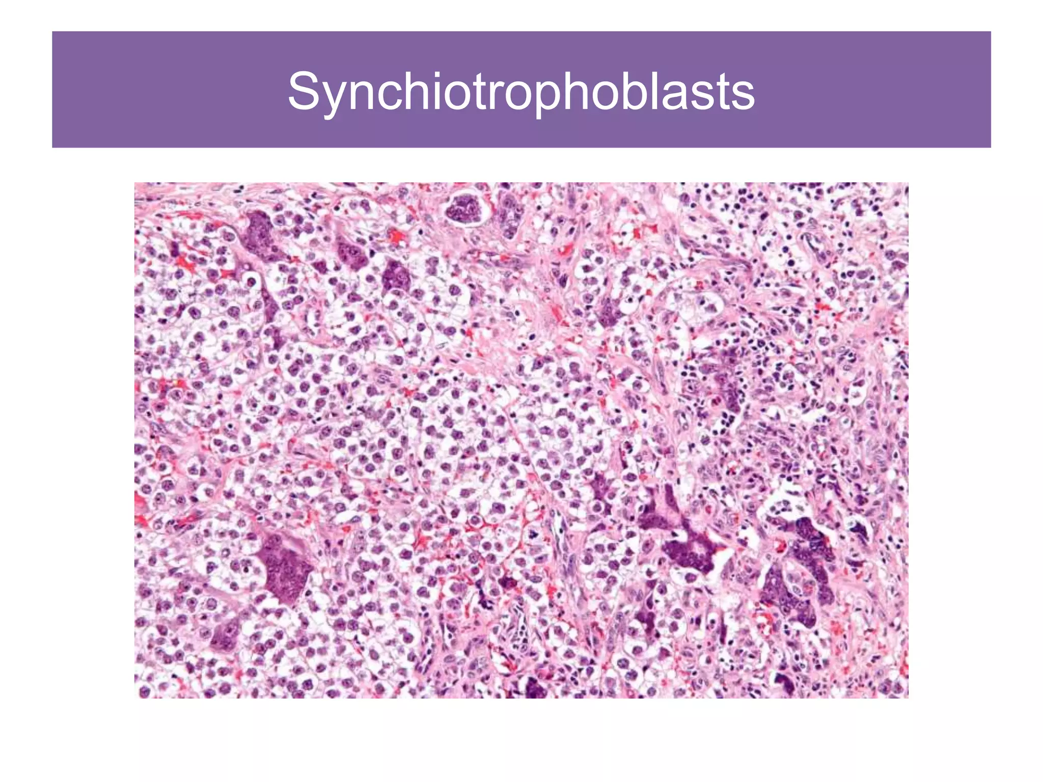 Synchiotrophoblasts
 