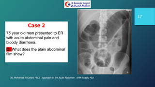 DR. Mohamad Al-Gailani FRCS Approach to the Acute Abdomen AHH Riyadh, KSA
17
Case 2
75 year old man presented to ER
with acute abdominal pain and
bloody diarrhoea.
Q: What does the plain abdominal
film show?
 