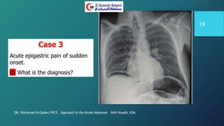 DR. Mohamad Al-Gailani FRCS Approach to the Acute Abdomen AHH Riyadh, KSA
19
Case 3
Acute epigastric pain of sudden
onset.
Q: What is the diagnosis?
 