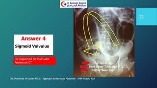 DR. Mohamad Al-Gailani FRCS Approach to the Acute Abdomen AHH Riyadh, KSA
22
Answer 4
Sigmoid Volvulus
Dx suspected on Plain AXR
Proven on CT Inverted-U sign
Bent Inner Tube sign
Coffee Bean sign
 