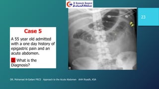 DR. Mohamad Al-Gailani FRCS Approach to the Acute Abdomen AHH Riyadh, KSA
23
Case 5
A 55 year old admitted
with a one day history of
epigastric pain and an
acute abdomen.
Q: What is the
Diagnosis?
 