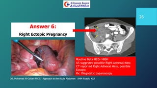 DR. Mohamad Al-Gailani FRCS Approach to the Acute Abdomen AHH Riyadh, KSA
26
Routine Beta HCG- HIGH
US suggested possible Right Adnexal Mass
CT reported Right Adnexal Mass, possible
Ectopic
Rx: Diagnostic Laparoscopy
Answer 6:
Right Ectopic Pregnancy
 