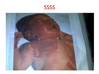Approach to the child with rash | PPTX