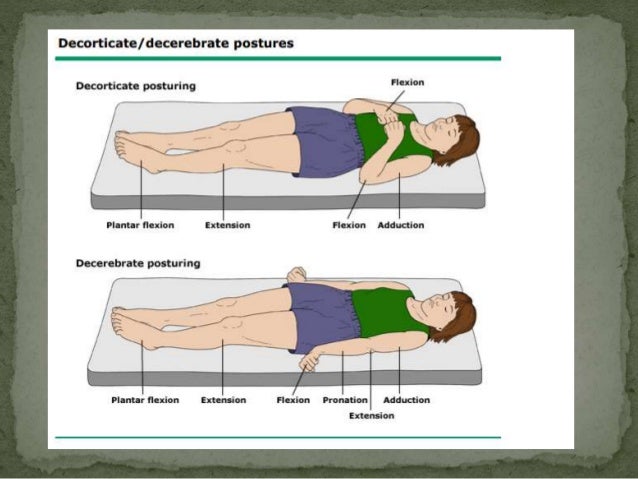 Approach To The Comatose Patient Approach To The Comatose Patient