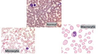 Approach_to_the_diagnosis_and_classification[1].pptx