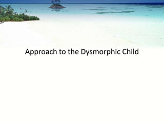 Approach to the Dysmorphic Child
 