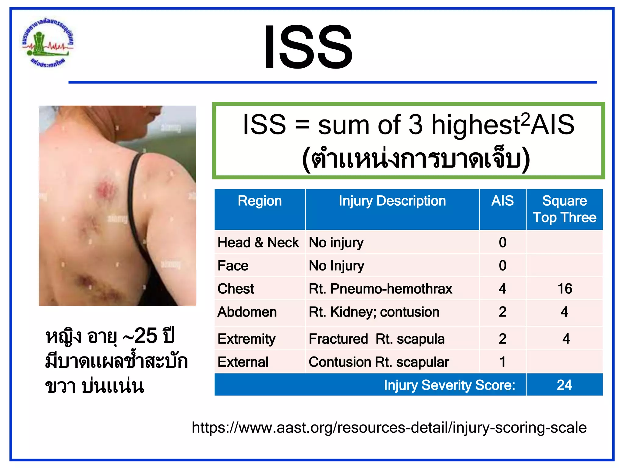 Iss Score Trauma Approach to the injured patient.pptx