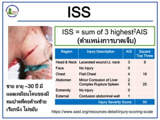 ISS
ISS = sum of 3 highest2AIS
(ตาแหน่งการบาดเจ็บ)
Region Injury Description AIS Square
Top Three
Head & Neck Lacerated wo...