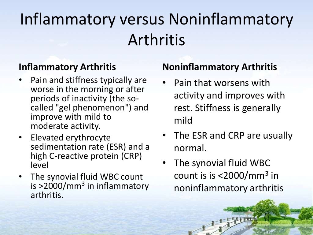 Approach to the patient with arthritis