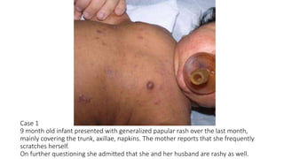 Napkin Rash Approach to the patient with pruritus | PPTX